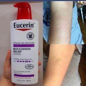 مرطب لازاله شعر تحت الجلد يوسيرين