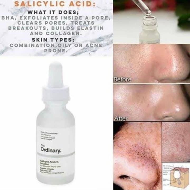 سالسيليك اسيد من ذا اورديناري - الصورة 2