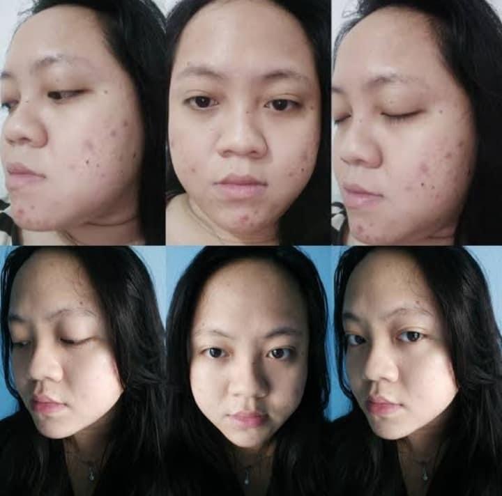 سالسيليك اسيد من ذا اورديناري - الصورة 3