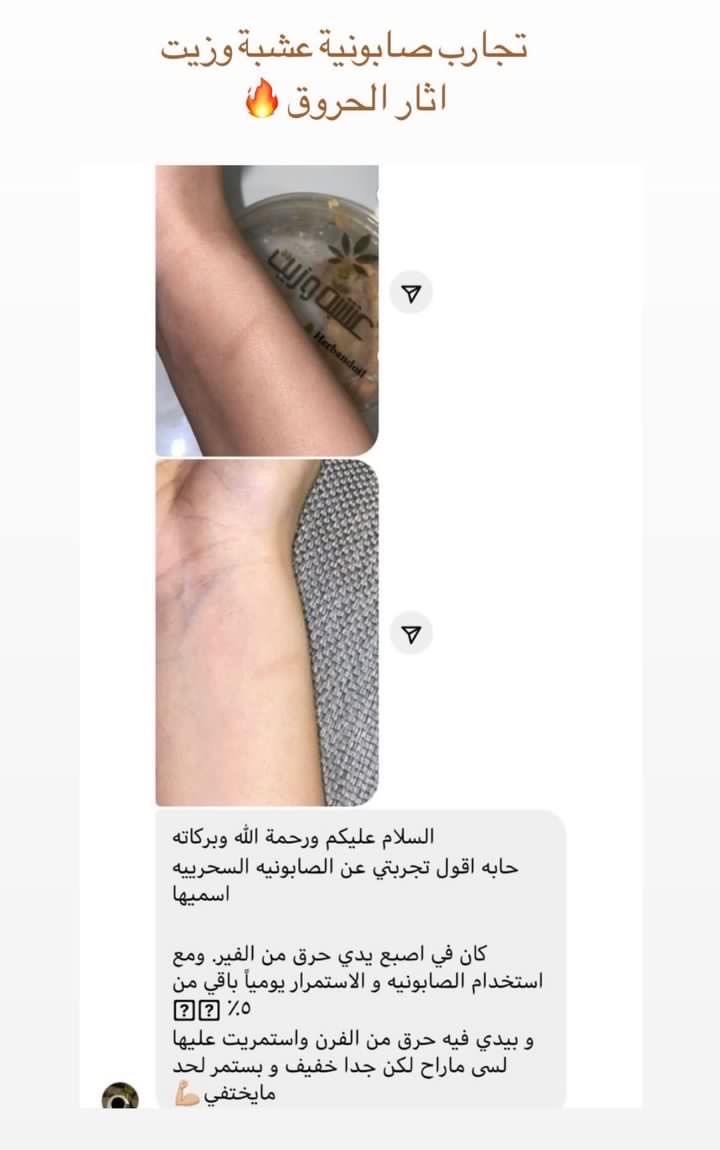 بوكس تبريمه وصابونية للتبييض وقفاز مجاناً عشبه وزيت - الصورة 12