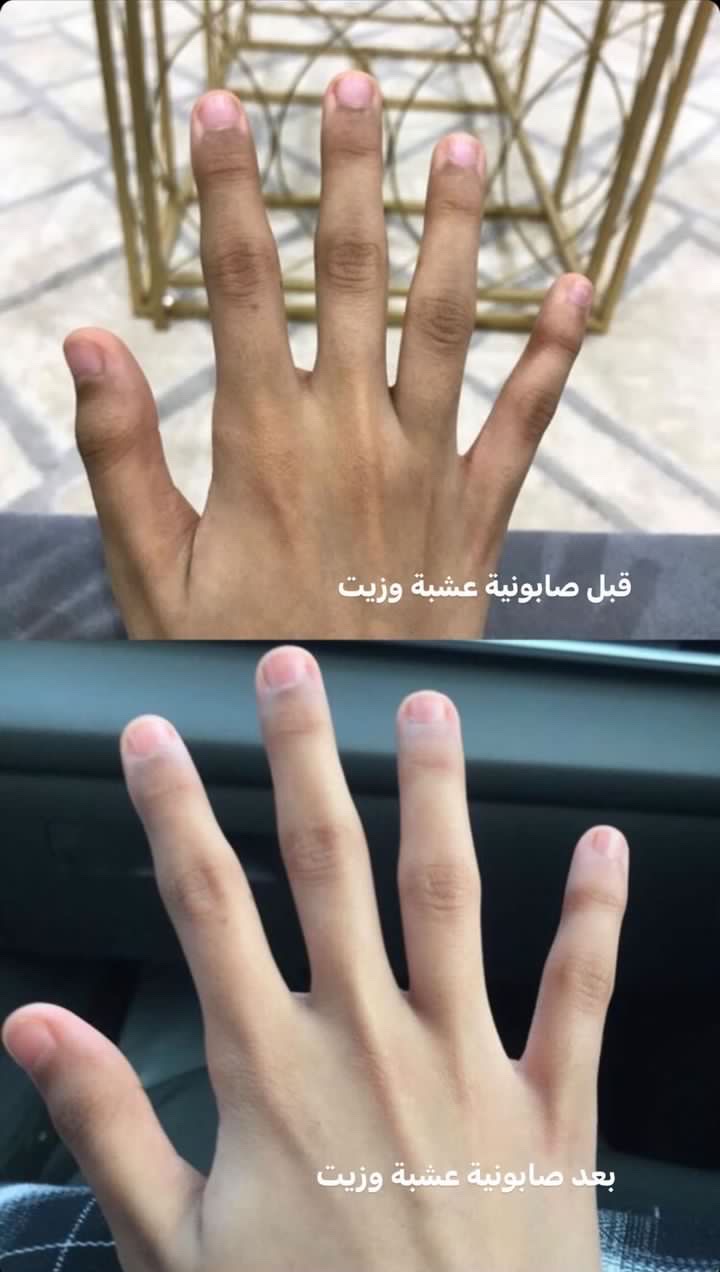 بوكس تبريمه وصابونية للتبييض وقفاز مجاناً عشبه وزيت - الصورة 2