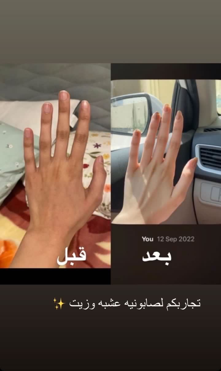 بوكس تبريمه وصابونية للتبييض وقفاز مجاناً عشبه وزيت - الصورة 3