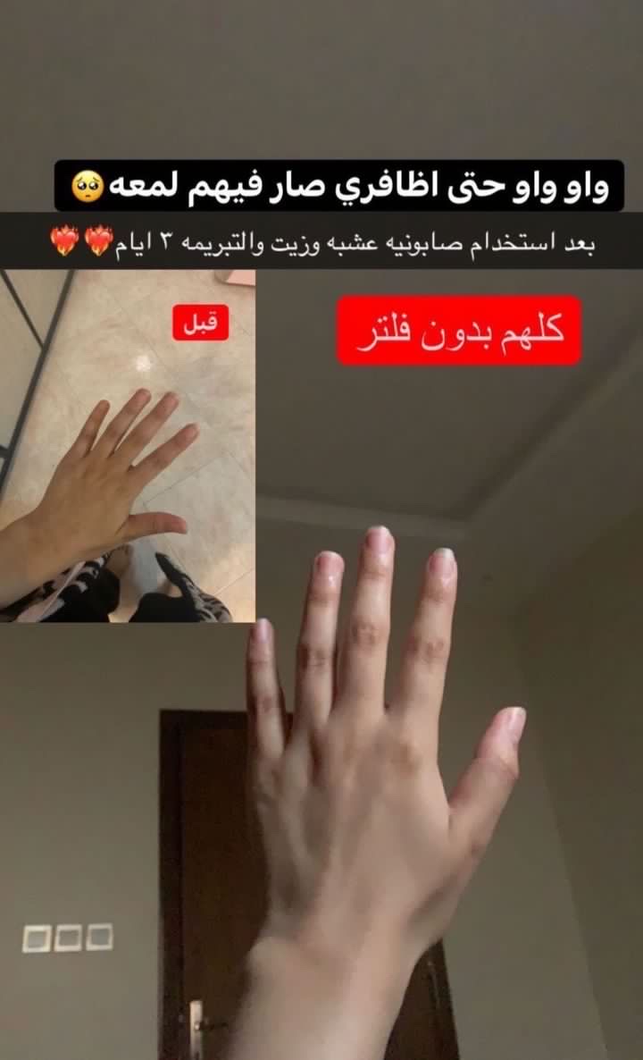 بوكس تبريمه وصابونية للتبييض وقفاز مجاناً عشبه وزيت - الصورة 9