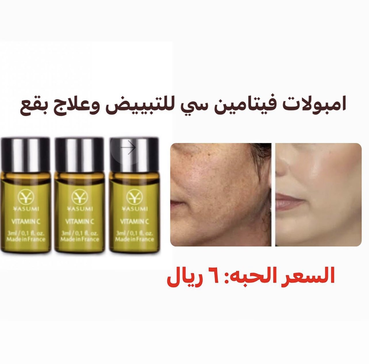 امبولات فيتامين سي للتبييض