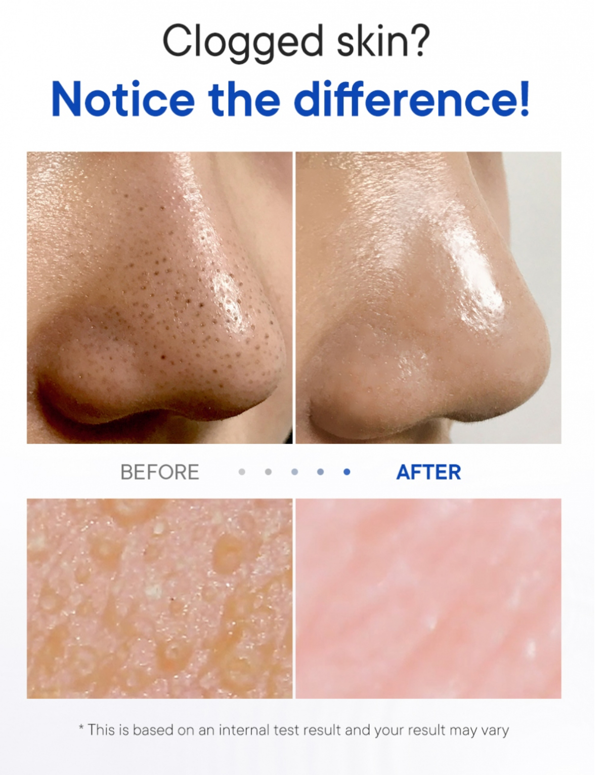 محلول اذابة دهون و رؤوس سوداء والبيضاء - الصورة 2