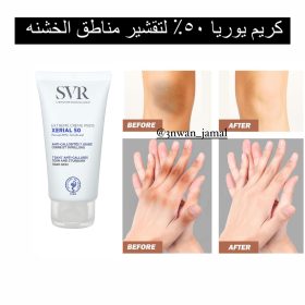 كريم يوريا ٥٠٪؜ من svr