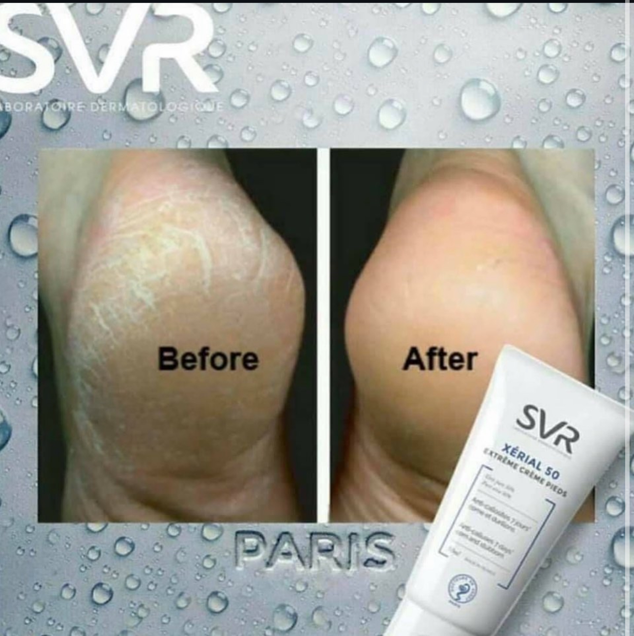 كريم يوريا ٥٠٪ من svr - الصورة 3